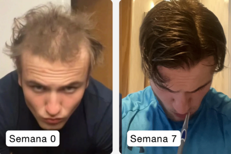 Resultado DermaFolix